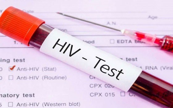 Sesau atende 1.060 pacientes com HIV em Camaçari e chama atenção para o Dezembro Vermelho